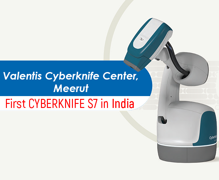 CyberKnife Treatment in Meerut